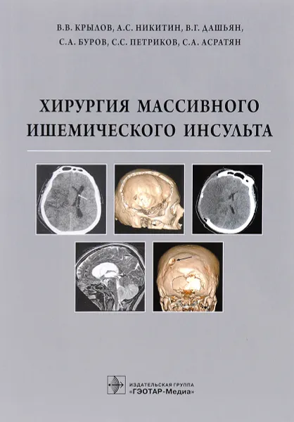 Обложка книги Хирургия массивного ишемического инсульта, В. В. Крылов, А. С. Никитин, В. Г. Дашьян, С. А. Буров, С. С. Петриков, С. А. Асратян