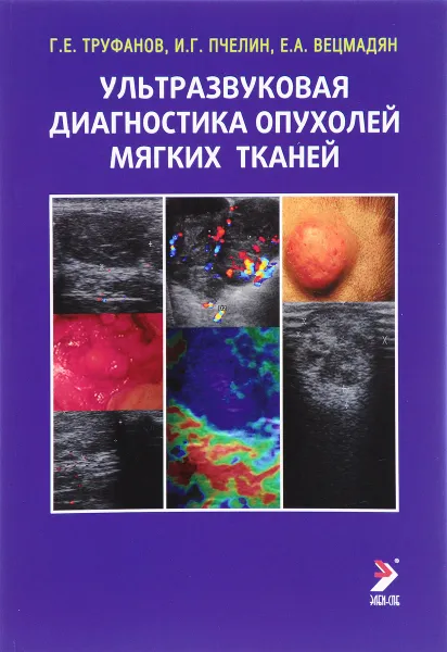 Обложка книги Ультразвуковая диагностика опухолей мягких тканей, Г. Е. Труфанов, И. Г. Пчелин, Е. А. Вецмадян