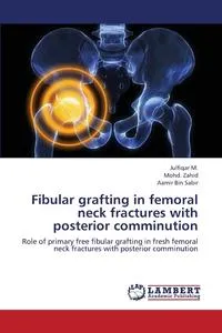 Обложка книги Fibular Grafting in Femoral Neck Fractures with Posterior Comminution, M. Julfiqar