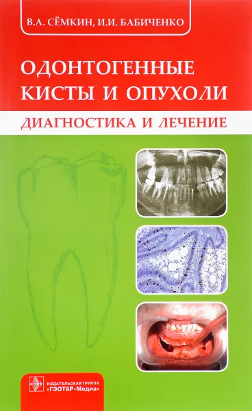 Обложка книги Одонтогенные кисты и опухоли, В. А. Сёмкин, И. И. Бабиченко