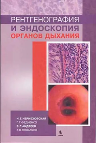 Обложка книги Рентгенография и эндоскопия органов дыхания, Н. Е. Чернеховская, Г. Г. Федченко, В. Г. Андреев, А. В. Поваляев