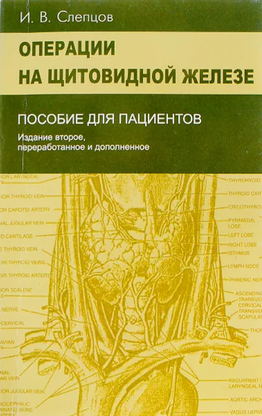 Обложка книги Операции на щитовидной железе. Пособие для пациентов, И.В. Слепцов