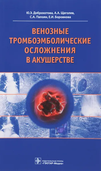 Обложка книги Венозные тромбоэмболические осложнения в акушерстве, Ю. Э. Доброхотова, А. А. Щеголев, С. А. Папоян, Е. И. Боровкова