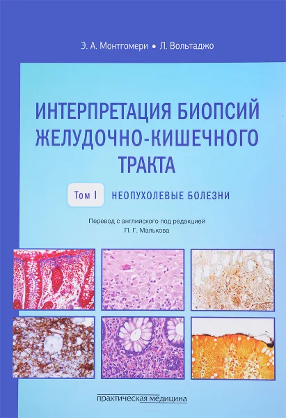 Обложка книги Интерпретация биопсий желудочно-кишечного тракта. Том 1. Неопухолевые болезни, Э. А. Монтгомери, Л. Вольтаджо