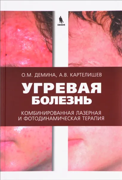 Обложка книги Угревая болезнь. Комбинированная лазерная и фотодинамическая терапия. Руководство для врачей, О. М. Демина, А. В. Картелишев