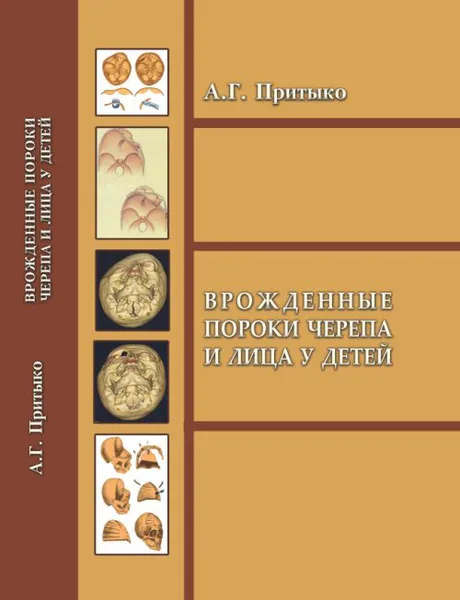 Обложка книги Врожденные пороки черепа и лица у детей, А. Г. Притыко