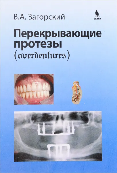 Обложка книги Перекрывающие протезы, В.А. Загорский