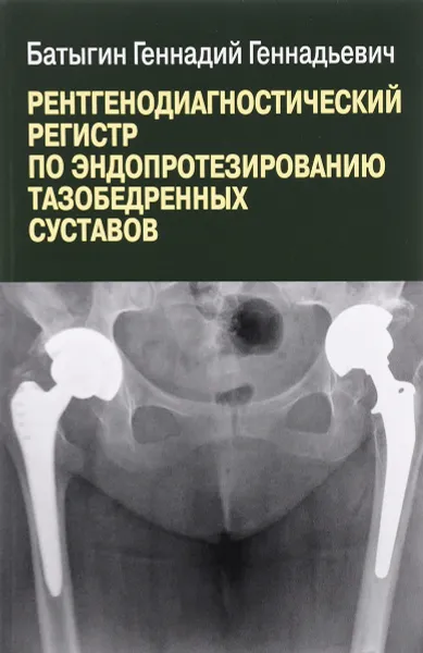 Обложка книги Рентгенологический регистр по эндопротезированию тазобедренных суставов, Геннадий Батыгин