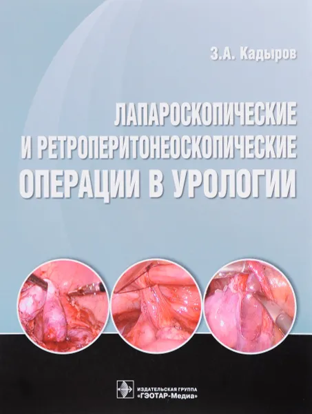 Обложка книги Лапароскопические и ретроперитонеоскопические операции в урологии, Зиератшо Кадыров,Владимир Рамишвили,Сулейман Сулейманов,Аминджон Одилов,Михаил Фаниев,Отари Гигиадзе,Никита Демин,Нурали Зокиров