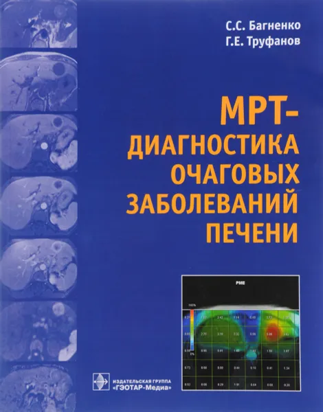 Обложка книги МРТ - диагностика очаговых заболеваний печени, С. С. Багненко, Г. Е. Труфанов