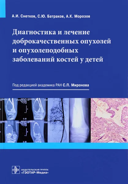 Обложка книги Диагностика и лечение доброкачественных опухолей и опухолеподобных заболеваний костей у детей, Сергей Миронов,Андрей Снетков,Сергей Батраков,Александр Морозов,Геннадий Берченко,Валерий Медик,Антон Франтов