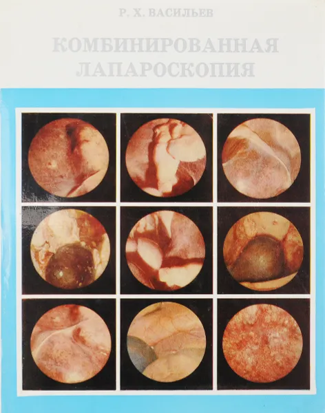 Обложка книги Комбинированная лапароскопия, Р. Х. Васильев