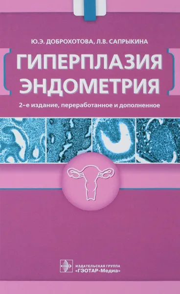 Обложка книги Гиперплазия эндометрия, Ю. Э. Доброхотова, Л. В. Сапрыкина
