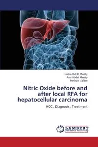 Обложка книги Nitric Oxide Before and After Local Rfa for Hepatocellular Carcinoma, Abd El Moety Hoda