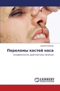 Обложка книги Perelomy Kostey Nosa, Semenov Sergey