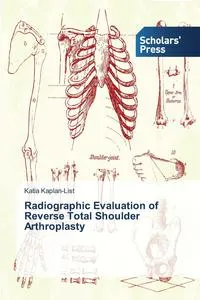 Обложка книги Radiographic Evaluation of Reverse Total Shoulder Arthroplasty, Kaplan-List Katia