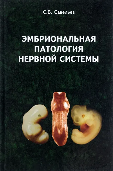 Обложка книги Эмбриональная патология нервной системы, С. В. Савельев