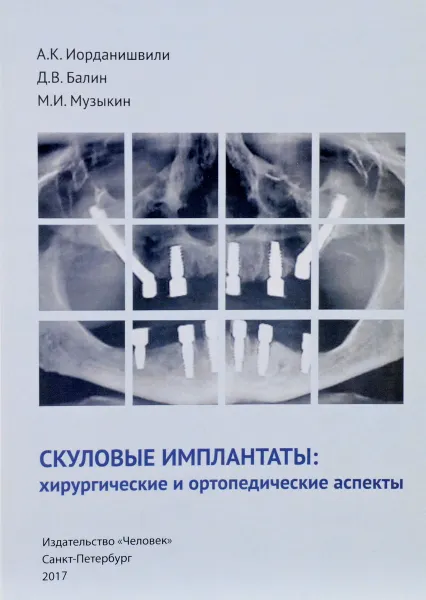 Обложка книги Скуловые имплантаты. Хирургические и ортопедические аспекты, А. К. Иорданишвили, Д. В. Балин, М. И. Музыкин