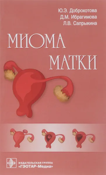 Обложка книги Миома матки. Руководство, Ю. Э. Доброхотова
