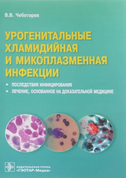 Обложка книги Урогенитальные хламидийная и микоплазменная инфекции. Последствия инфицирования, лечение, В. В. Чеботарев