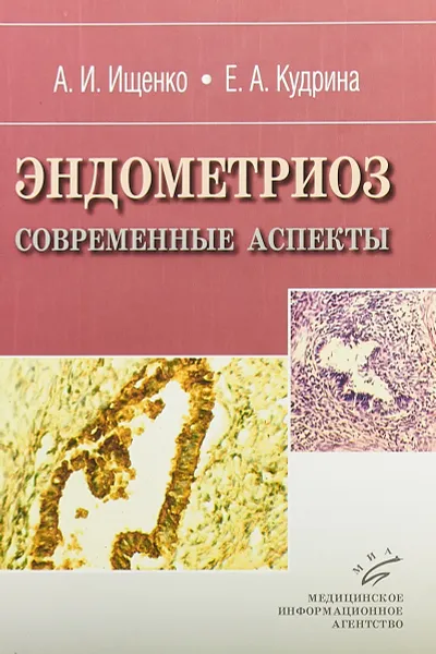 Обложка книги Эндометриоз. Современные аспекты, А. И. Ищенко, Е. А. Кудрина