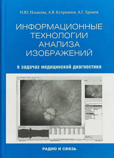 Обложка книги Информационные технологии АНАЛИЗА ИЗОБРАЖЕНИЙ в задачах медицинской диагностики, Ильясова Н.Ю, Куприянов А.В., Храмов А.Г.