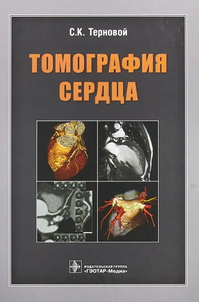 Обложка книги Томография сердца, С. К. Терновой