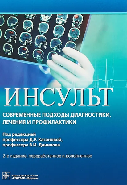 Обложка книги Инсульт. Современные подходы диагностики, Наталья Агафонова,Андрей Алексеев,Елена Баранова