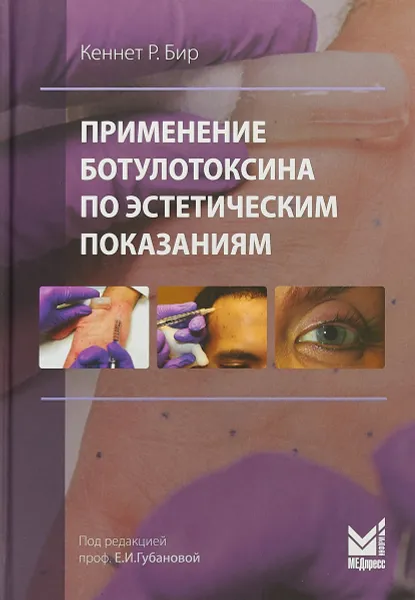 Обложка книги Применение ботулотоксина по эстетическим показаниям, Кеннет Бир