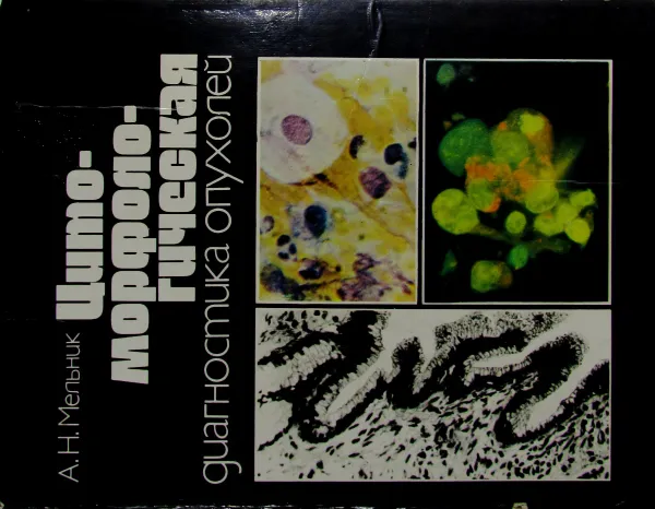 Обложка книги Цитоморфологическая диагностика опухолей, А.Н. Мельник