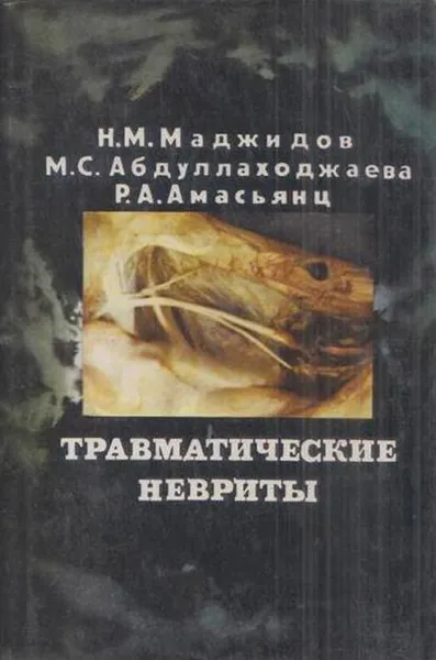 Обложка книги Травматические невриты (клинико-экспериментальное исследование), Маджидов Н.М., Абдуллаходжаева М.С.,Амасьяц Р.А.