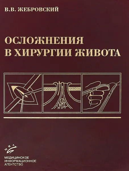 Обложка книги Осложнения в хирургии живота, В. В. Жебровский