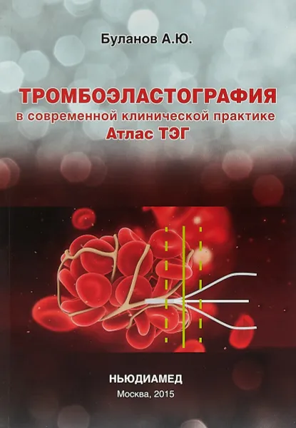 Обложка книги Тромбоэластография в современной клинической практике. Атлас ТЭГ, Андрей Буланов