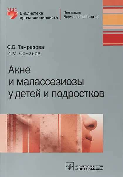 Обложка книги Акне и малассезиозы у детей и подростков, О. Б. Тамразова, И. М. Османов