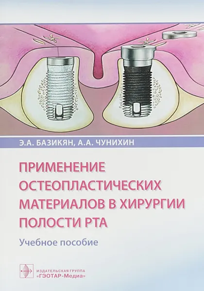 Обложка книги Применение остеопластических материалов в хирургии полости рта, Э. А. Базикян, А. А. Чунихин