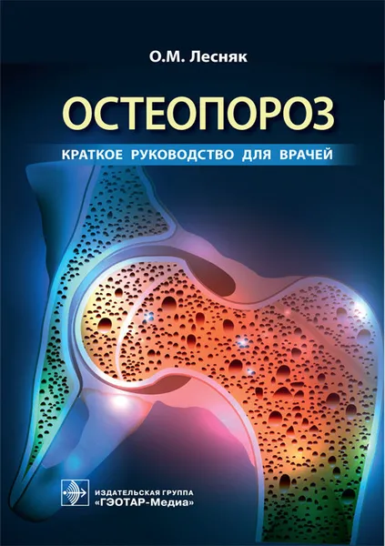 Обложка книги Остеопороз. Краткое руководство для врачей, О. М. Лесняк