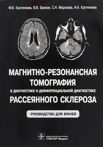 Обложка книги Магнитно-резонансная томография в диагностике и дифференциальной диагностике рассеянного склероза. Руководство для врачей, М. В. Кротенкова, В. В. Брюхов, С. Н. Морозова, И. А. Кротенкова