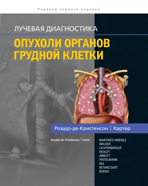 Обложка книги Лучевая диагностика. Опухоли органов грудной клетки, М. Л. Розадо-де-Кристенсон, Б. В. Картер