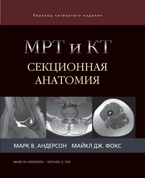 Обложка книги МРТ и КТ. Секционная анатомия, Марк В. Андерсон, Майкл Дж. Фокс