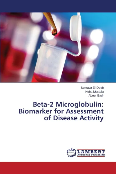 Обложка книги Beta-2 Microglobulin. Biomarker for Assessment of Disease Activity, El-Deeb Somaya, Mostafa Heba, Badr Abeer