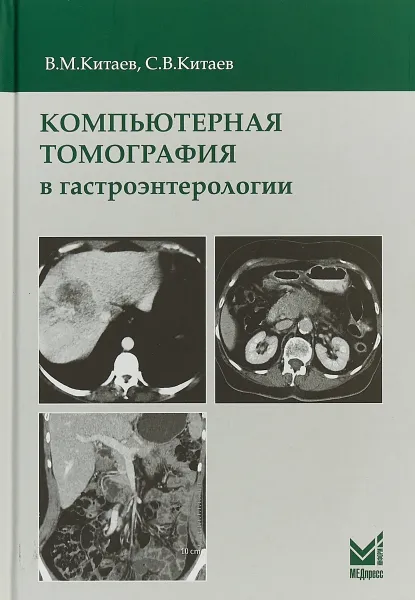 Обложка книги Компьютерная томография в гастроэнтерологии, В.М. Китаев