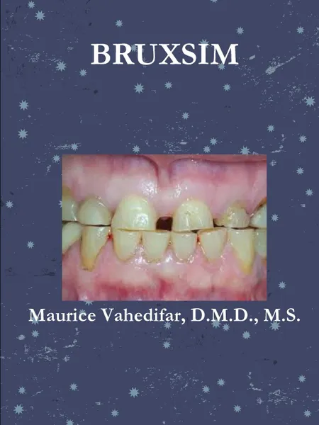 Обложка книги BRUXSIM, D.M.D. M.S. Maurice . Vahedifar