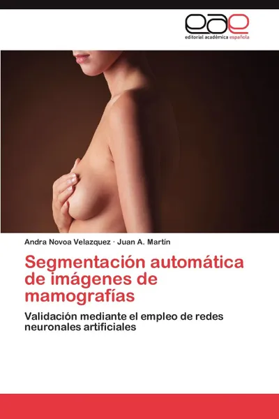 Обложка книги Segmentacion automatica de imagenes de mamografias, Novoa Velazquez Andra, Martín Juan A.