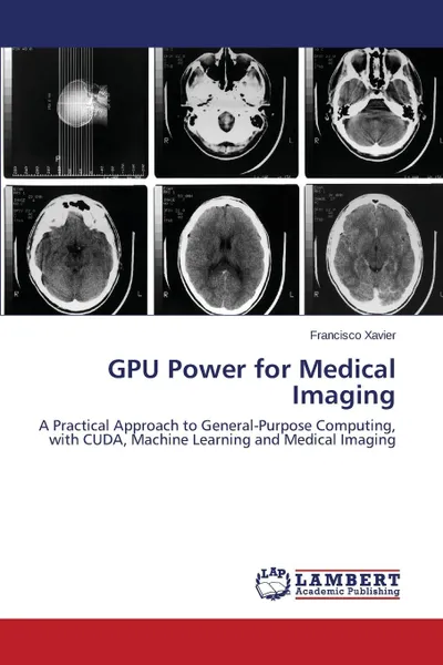 Обложка книги Gpu Power for Medical Imaging, Xavier Francisco