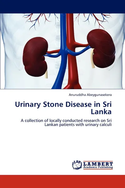 Обложка книги Urinary Stone Disease in Sri Lanka, Anuruddha Abeygunasekera