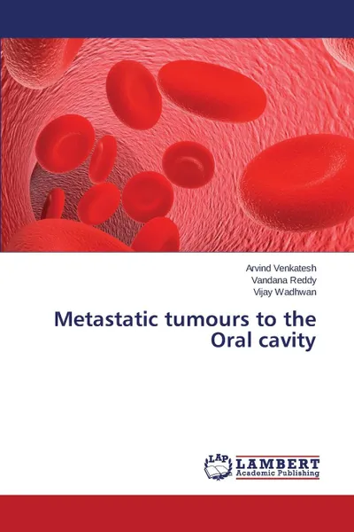 Обложка книги Metastatic tumours to the Oral cavity, Venkatesh Arvind, Reddy Vandana, Wadhwan Vijay