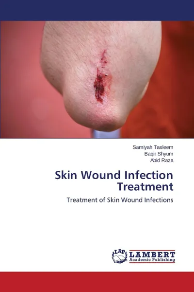 Обложка книги Skin Wound Infection Treatment, Tasleem Samiyah, Shyum Baqir, Raza Abid