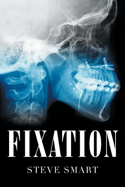 Обложка книги Fixation, Steve Smart