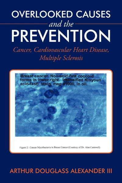 Обложка книги Overlooked Causes and the Prevention. Cancer, Cardiovascular Heart Disease, Multiple Sclerosis, Arthur Douglas III Alexander