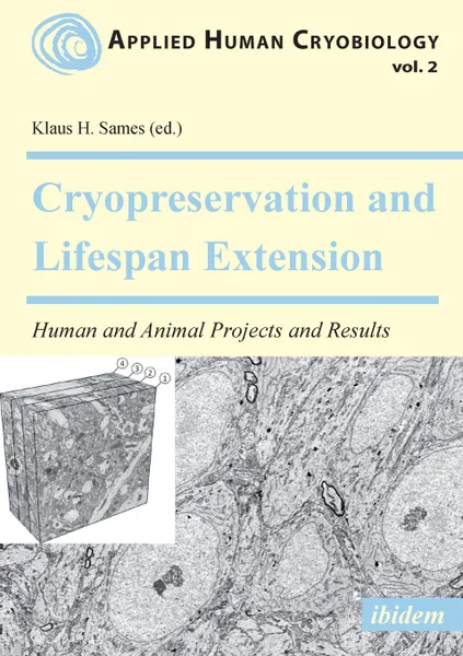 Обложка книги Cryopreservation and Lifespan Extension. Human and Animal Projects and Results, Robert L. McIntyre, Gregory M. Fahy
